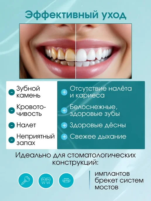 Портативный ирригатор для зубов и десен, белый, фото 3