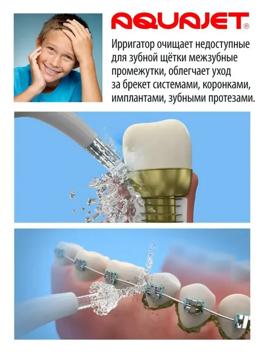 Портативный ирригатор для зубов и десен, белый, фото 7