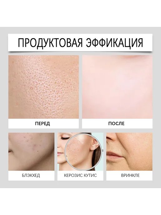 eelhoe мезороллер набор для лица Способствует регенерации коллагена, вариант, фото 6