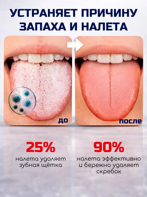 ALLHOME101 Скребок для языка от налета набор, голубой, фото 2