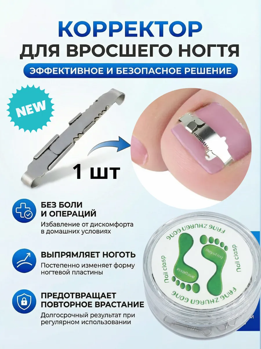 Корректор для вросших ногтей