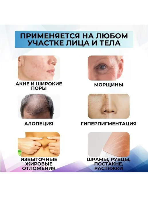Картриджи дермапен 36-игольные, винтовые, 10 шт, 10 шт, фото 3