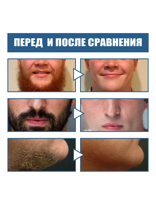 EAST MOON Мужская бритва Поддерживайте свое лицо в чистоте и порядке, вариант, фото 8