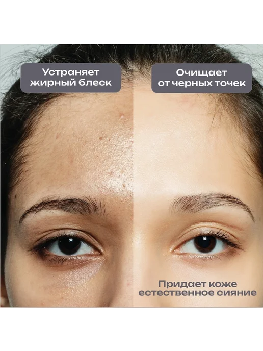 Пилинг-скраб для жирной и проблемной кожи лица, 80 мл, 80 мл, фото 5