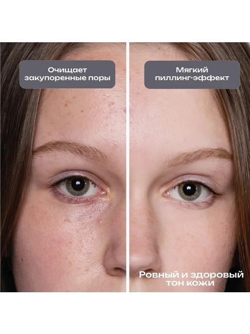Пилинг-скраб для жирной и проблемной кожи лица, 80 мл, 80 мл, фото 6