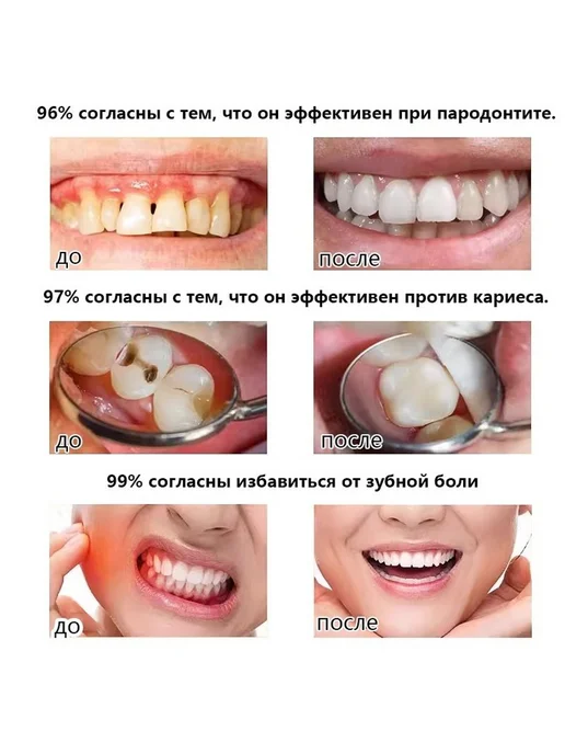Охлаждающий спрей для рта 20 мл, без спирта, 20 мл, фото 4