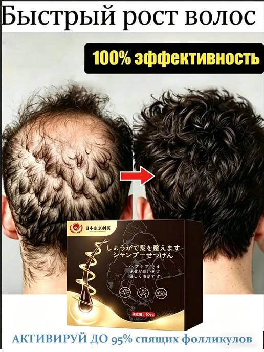 Мыло для роста волос и против выпадения укрепления, вариант, фото 2