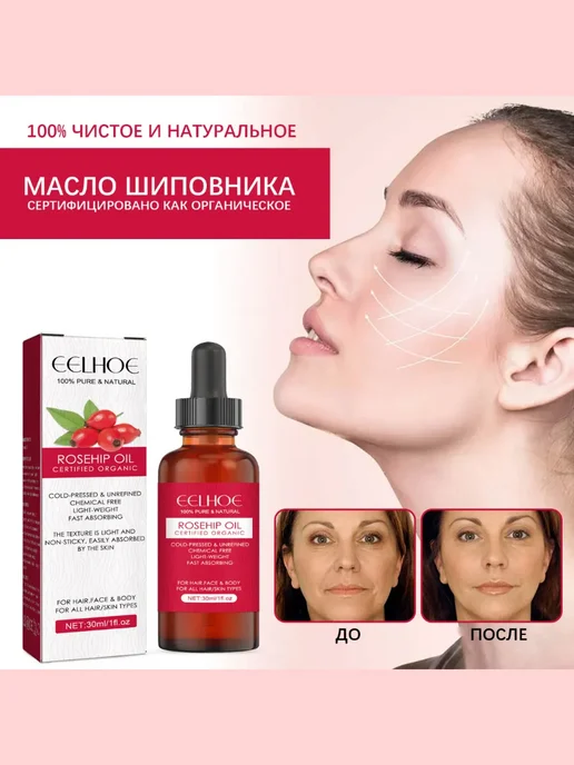 eelhoe Увлажняющее эфирное масло шиповника для лица и тела, 30 мл, фото 5