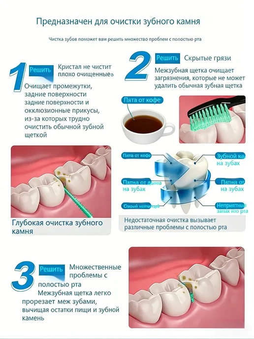 Ершики межзубные 0.4 мм для брекетов, 200 шт, 200 шт, фото 6