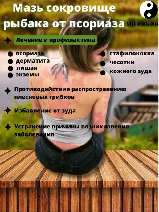 Китайская мазь от псориаза и дерматита, вариант, фото 2