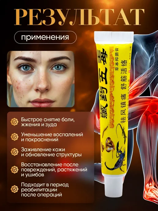 Китайская обезболивающая чудо мазь 5 ядов, вариант, фото 5